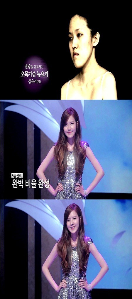 ศัลยกรรมหน้าเหมือน เจสสิก้า 