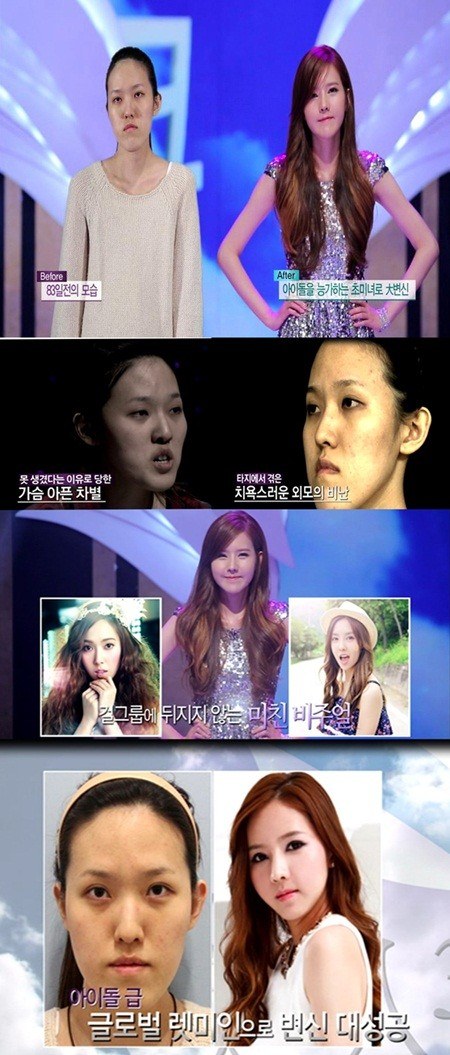 ศัลยกรรมหน้าเหมือน เจสสิก้า 