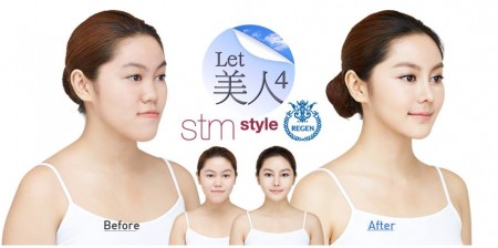 สาวไทยศัลยกรรมเกาหลี