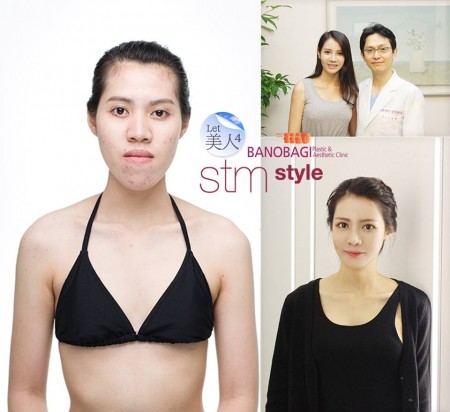 สาวไทยศัลยกรรมเกาหลี