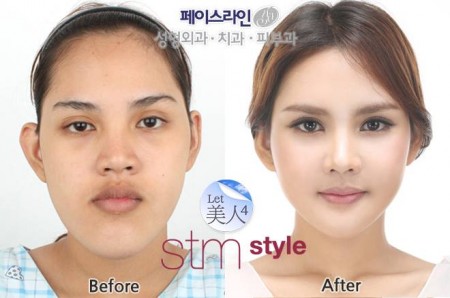 สาวไทยศัลยกรรมเกาหลี