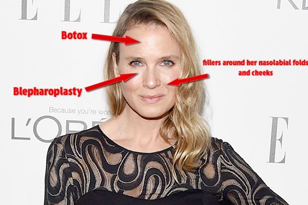  เรเน่ เซลเวเกอร์