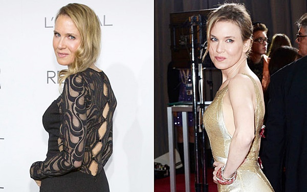  เรเน่ เซลเวเกอร์