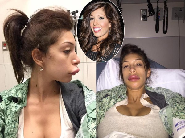 ศัลยกรรมปาก