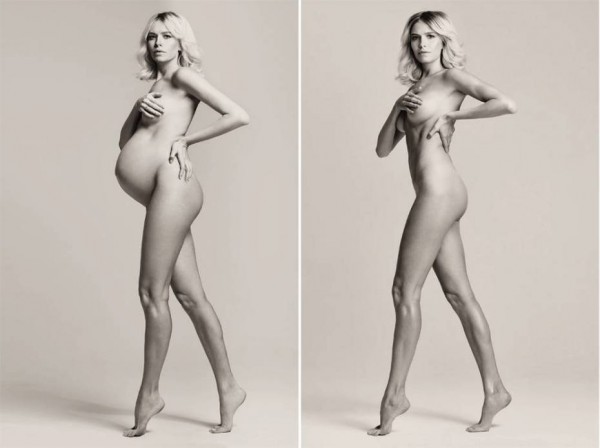 ลดหุ่นหลังคลอด 