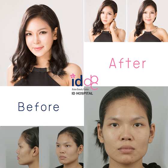 ศัลยกรรม