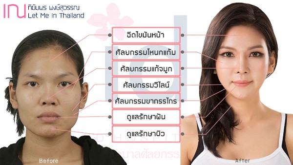  เณ-ทิฆัมพร