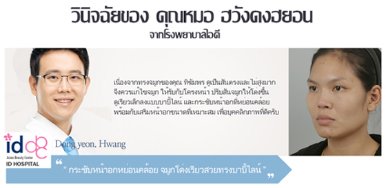 ศัลยกรรมเกาหลี