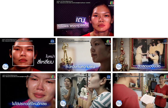  ศัลยกรรม