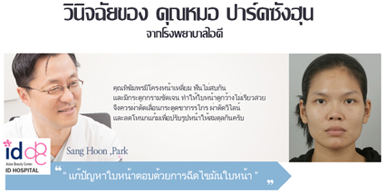 ศัลยกรรมเกาหลี