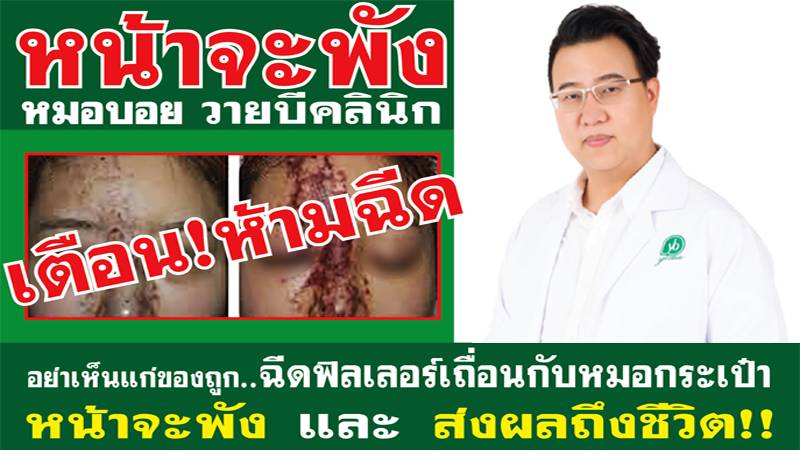 YB Clinic คลีนิค ความงาม ฉีดฟิลเลอร์ ฟิลเลอร์ ริ้วรอย ร่องแก้ม ศัลยกรรม หน้าพัง หมอ หมอกระเป๋า หมอบอยybclinic เสริมความงาม เสริมจมูก เสริมหน้าอก