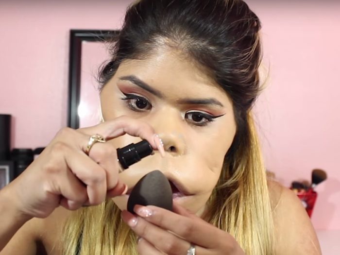 เนื้องอกท่อน้ำเหลือง