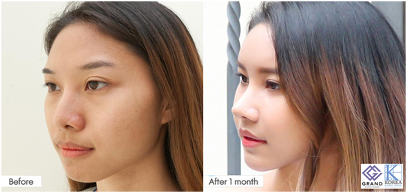 ศัลยกรรมแปลงโฉม