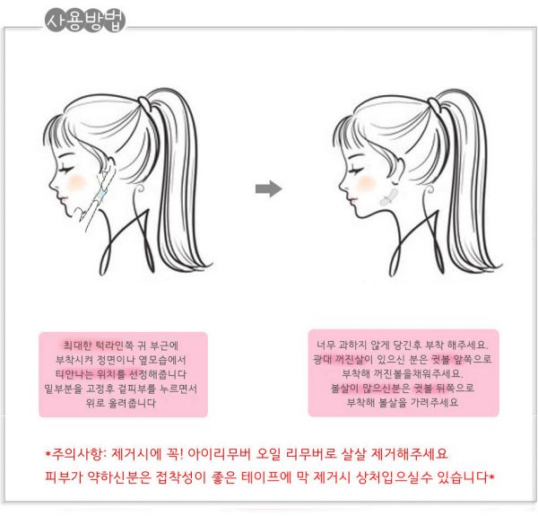 พลาสเตอร์ V-Shape