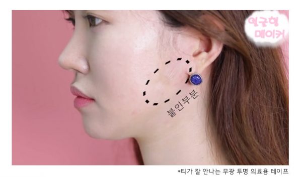 พลาสเตอร์ V-Shape