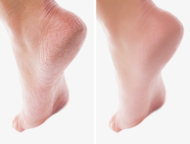 14 เคล็ดลับ วิธีโกงสวย