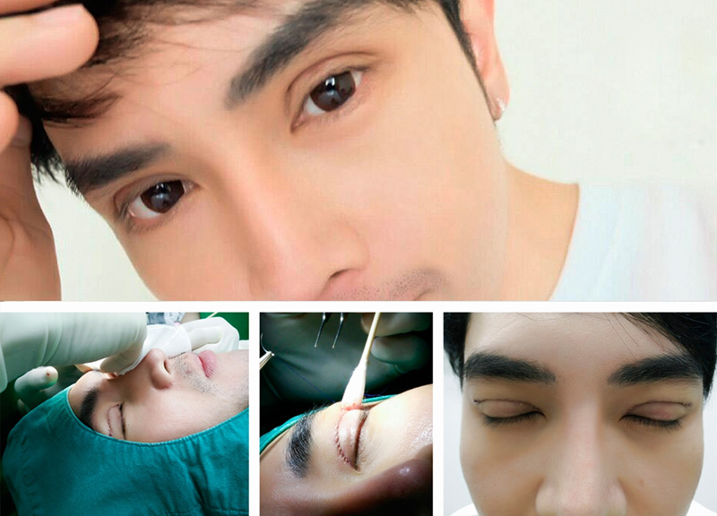 ทำตาสองชั้น