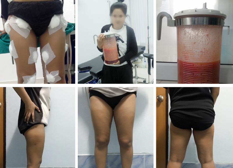 เทรนด์ความงาม