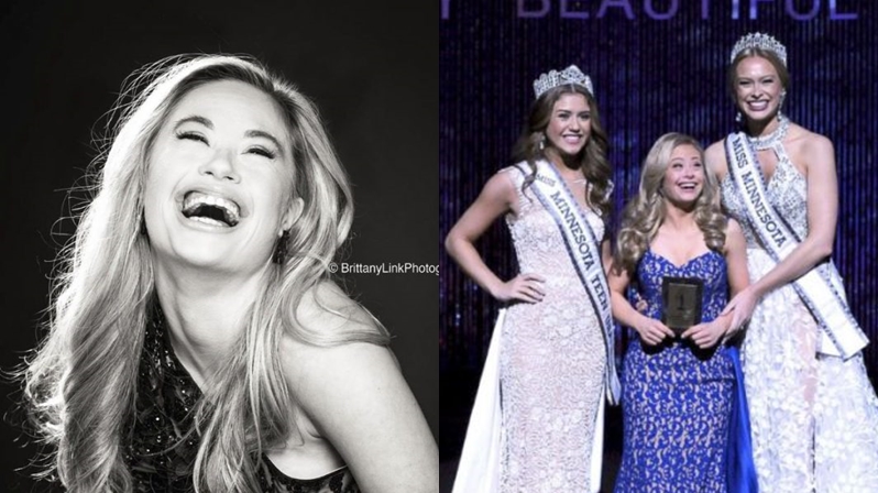 นางงาม นางงามดาวน์ซินโดรม ประกวดนางงาม มิสยูเอสเอ มิเคย์ลา โฮล์มเกร็น