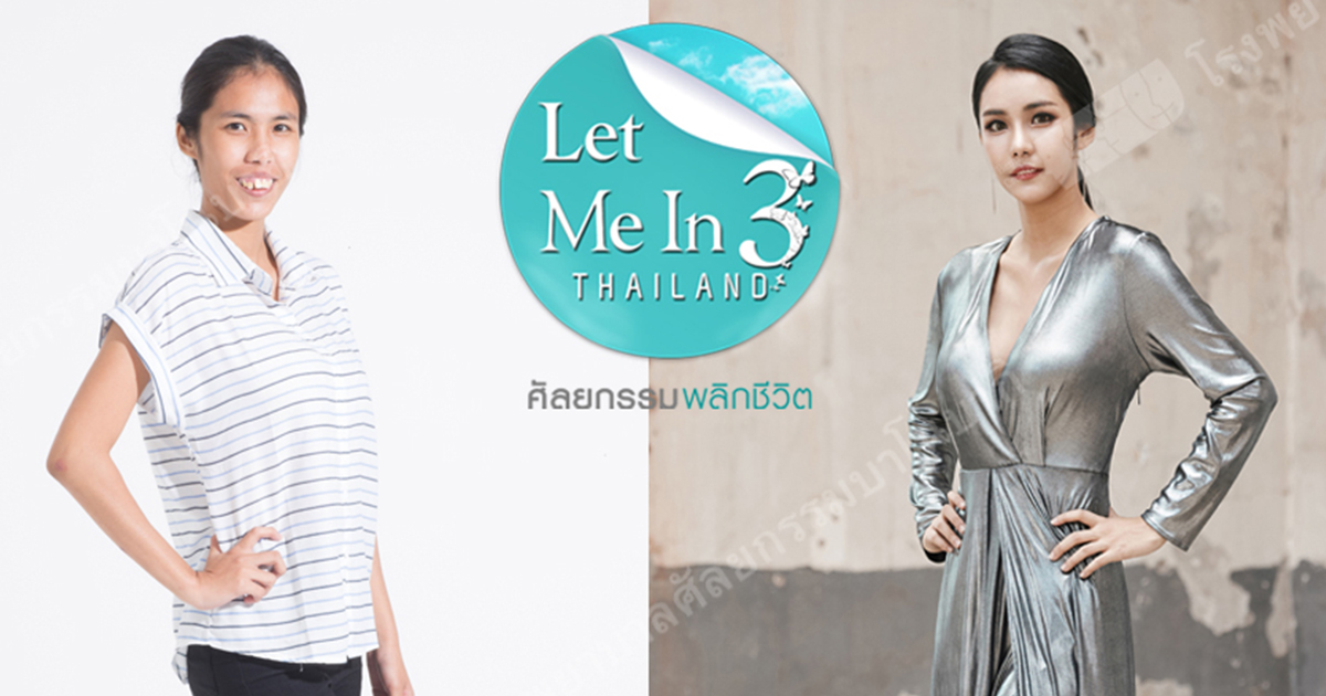 Let Me In Thailand บาโนบากิ ผ่าตัด ศัลยกรรม