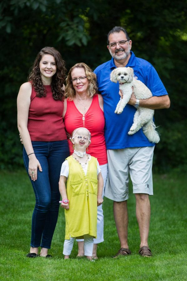 Michelle Kish โรคหายาก