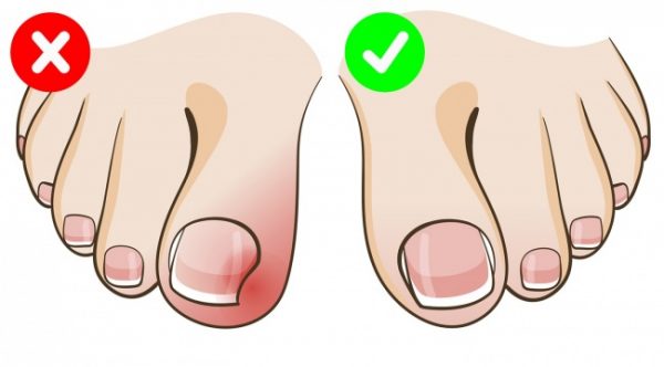  สุขอนามัย