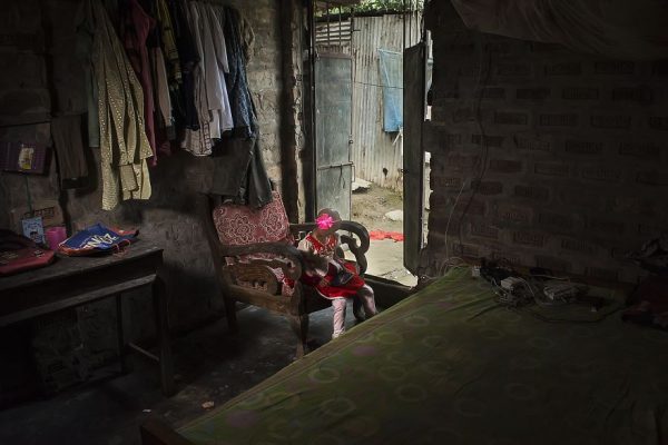 โรคชราในเด็ก