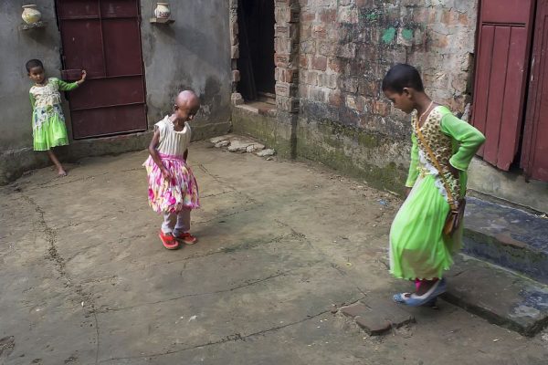 โรคชราในเด็ก