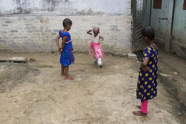 โรคชราในเด็ก