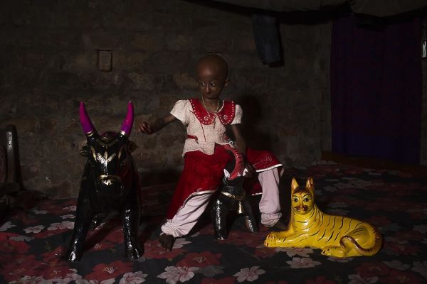 โรคชราในเด็ก