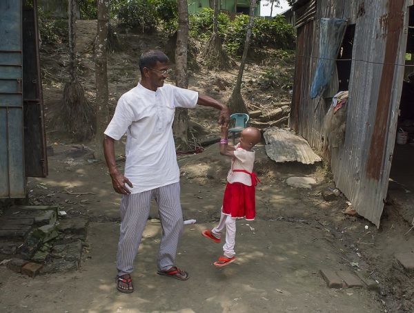 โรคชราในเด็ก