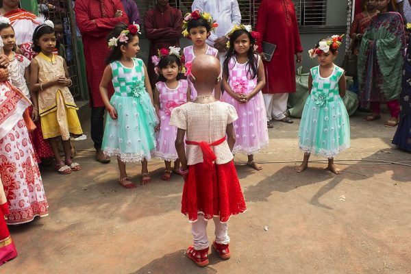 โรคชราในเด็ก