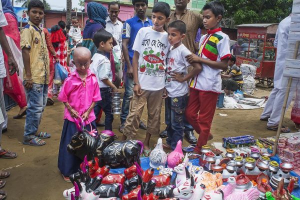 โรคชราในเด็ก