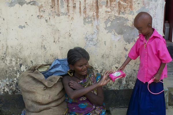 โรคชราในเด็ก