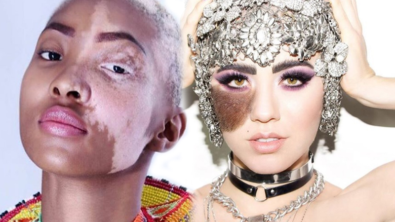 Anastasia Zhidkova Kgothi 'Iman' Dithebe Khoudia Diop Maeva Giani Marshall Sarah McDaniel Winnie Harlo นางแบบ นางแบบระดับโลก นางแบบแปลก โรคด่างขาว