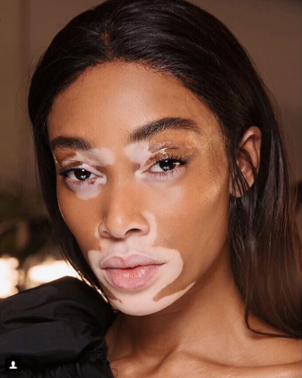 นางแบบระดับโลก