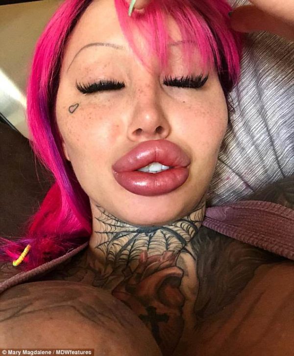 ศัลยกรรม