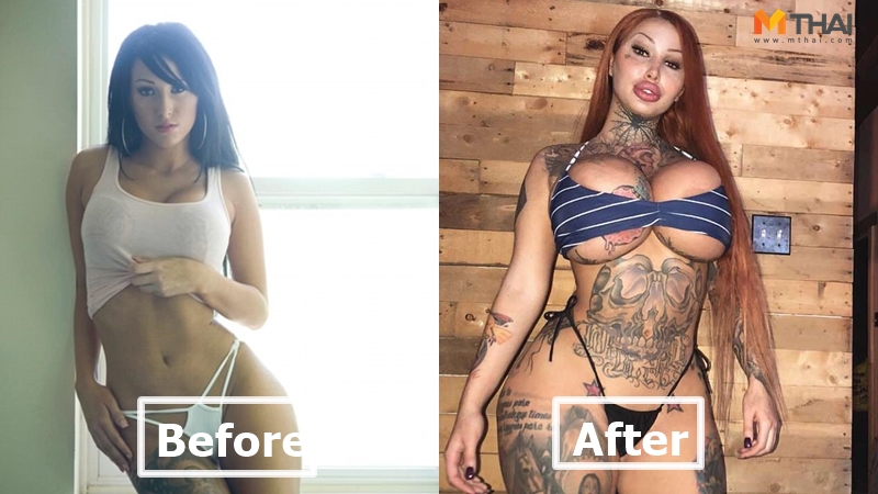 ความสวยความงาม ศัลยกรรม เสริมหน้าอก