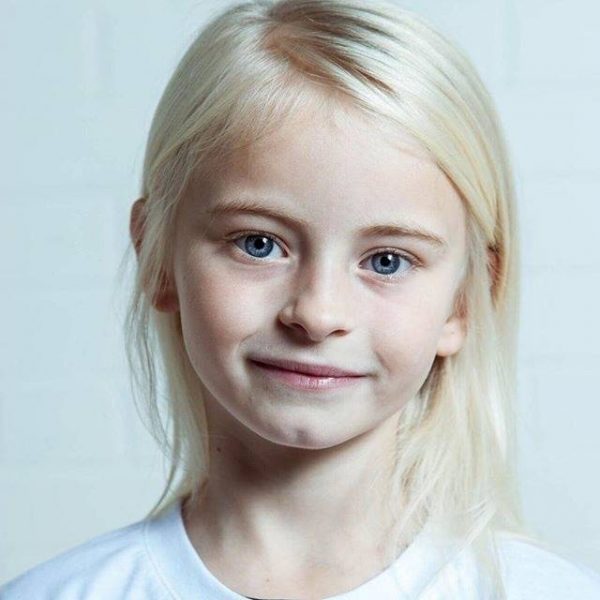 นางแบบพิการ