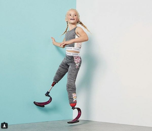 นางแบบพิการ