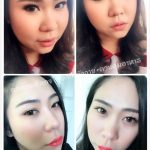 ลดน้ำหนัก