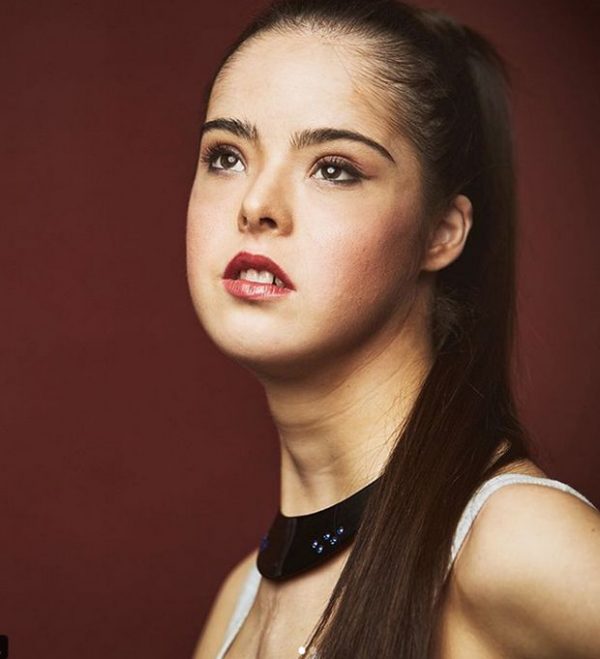 นางแบบดาวน์ซินโดรม