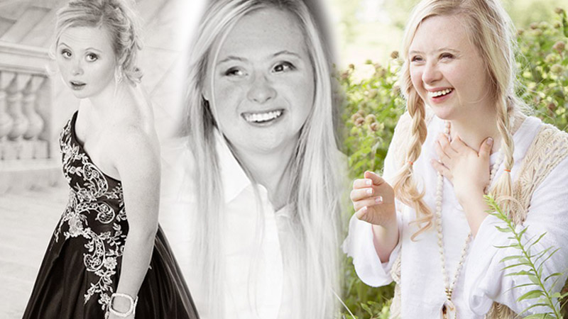 กำลังใจ ดาวน์ซินโดรม นางแบบ นางแบบดาวน์ซินโดรม ผู้หญิงต้นแบบ