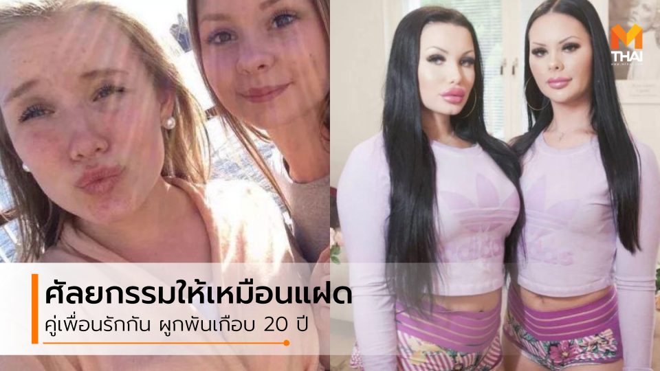 Julia Bergman Sofia Hagenlöv ทำศัลยกรรม ศัลยกรรม